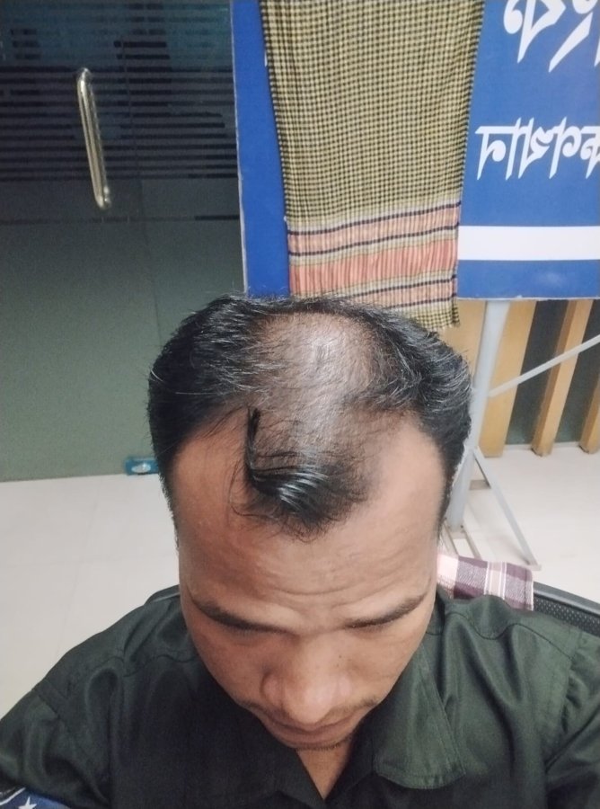 ব্যবহারের আগে